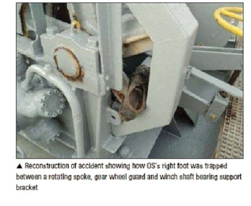 Real Life Accident: Foot Trapped And Injured In Windlass Gear
