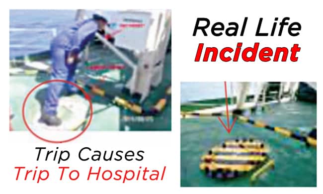 Trip-Causes-Trip-To-Ship’s-Hospital